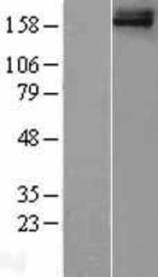 Western Blot: QBRICK/FREM1 Overexpression Lysate [NBL1-10830]