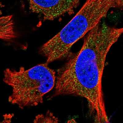 Immunocytochemistry/ Immunofluorescence: FREM2 Antibody [NBP1-85049]