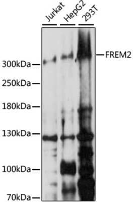 Western Blot: FREM2 AntibodyAzide and BSA Free [NBP3-05057]