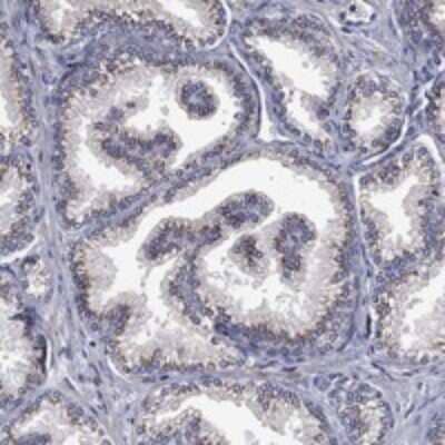 Immunohistochemistry-Paraffin: FRG1 Antibody [NBP3-17715]