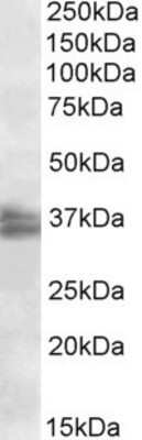 Western Blot: FRG1 Antibody [NBP1-49864]