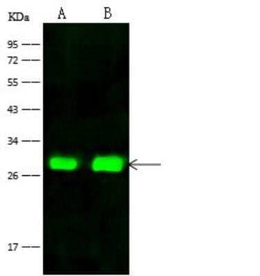 Western Blot: FRG1 Antibody [NBP2-99204]