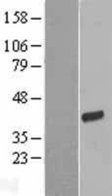 Western Blot: FRG1 Overexpression Lysate [NBP2-07869]