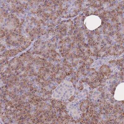 Immunohistochemistry: FRG2A Antibody [NBP2-46754]