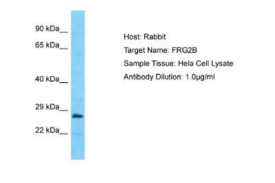 Western Blot: FRG2B Antibody [NBP2-82843]