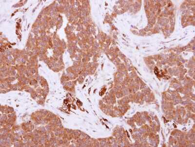 Immunohistochemistry-Paraffin: Frk Antibody [NBP2-16534]