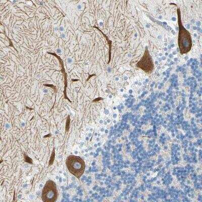 Immunohistochemistry-Paraffin: FRMD4B Antibody [NBP1-93709]