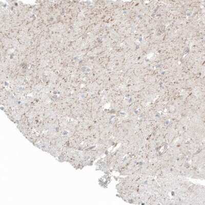 Immunohistochemistry-Paraffin: FRMD5 Antibody (CL9503) [NBP2-88935]