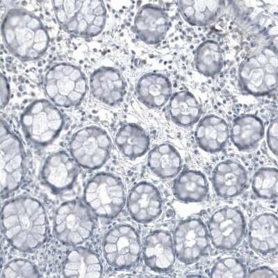Immunohistochemistry-Paraffin: FRMD5 Antibody (CL9503) [NBP2-88935]