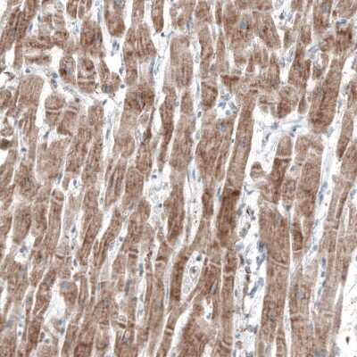 Immunohistochemistry-Paraffin: FRMD5 Antibody (CL9503) [NBP2-88935]