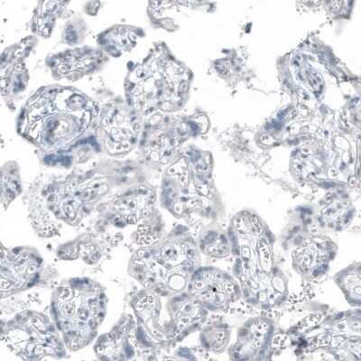 Immunohistochemistry-Paraffin: FRMD5 Antibody (CL9503) [NBP2-88935]