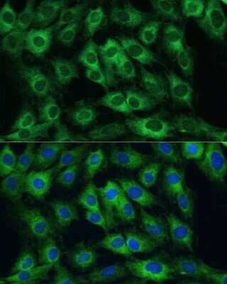 Immunocytochemistry/ Immunofluorescence: FRMD6 Antibody - Azide and BSA Free [NBP3-05019]