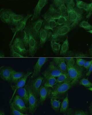 Immunocytochemistry/ Immunofluorescence: FRMD6 Antibody - Azide and BSA Free [NBP3-05019]