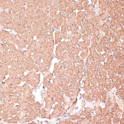 Immunohistochemistry-Paraffin: FRMD6 Antibody - Azide and BSA Free [NBP3-05019]