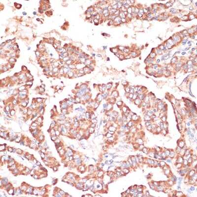 Immunohistochemistry-Paraffin: FRMD6 Antibody - Azide and BSA Free [NBP3-05019]