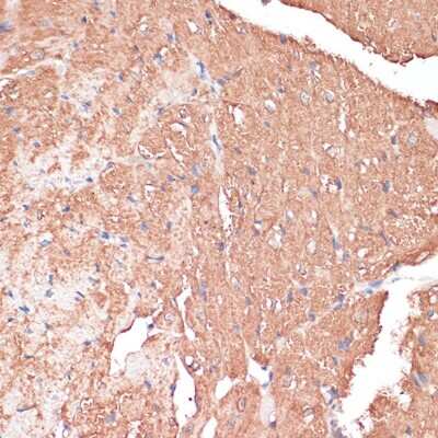 Immunohistochemistry-Paraffin: FRMD6 Antibody - Azide and BSA Free [NBP3-05019]