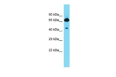 Western Blot: FRMD6 Antibody [NBP2-84033]