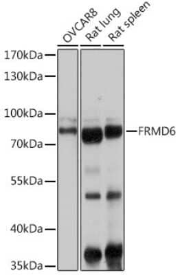 Western Blot: FRMD6 AntibodyAzide and BSA Free [NBP3-05019]