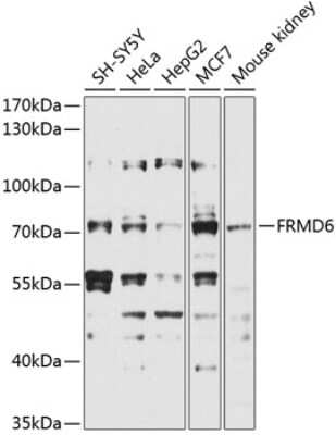 Western Blot: FRMD6 AntibodyAzide and BSA Free [NBP3-05019]