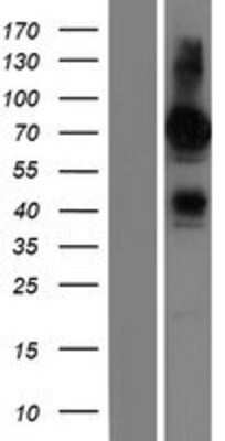 Western Blot: FRMD6 Overexpression Lysate [NBP2-05400]