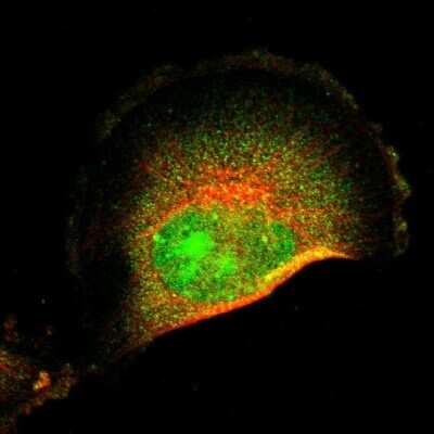 Immunocytochemistry/ Immunofluorescence: FRMD8 Antibody [NBP2-55142]