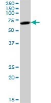 Western Blot: FRMD8 Antibody [H00083786-B01P]