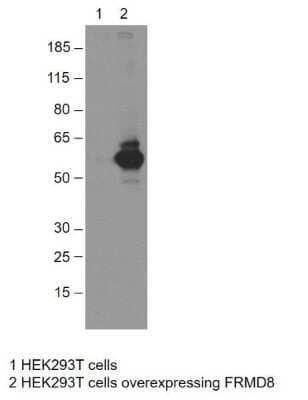 Western Blot: FRMD8 Antibody [NBP1-83884]