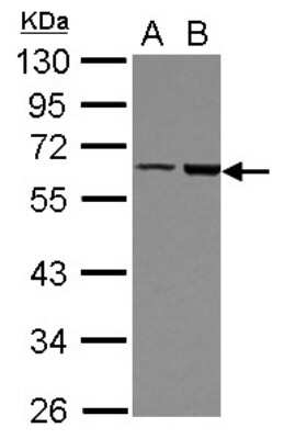 Western Blot: FRMD8 Antibody [NBP2-16535]
