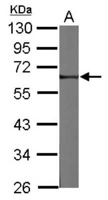 Western Blot: FRMD8 Antibody [NBP2-16535]