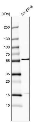 Western Blot: FRMD8 Antibody [NBP2-55142]