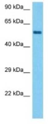 Western Blot: FRMD8 Antibody [NBP3-10191]