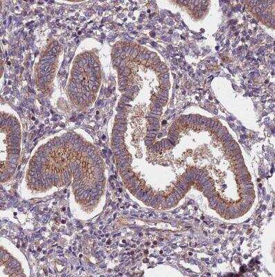 Immunohistochemistry-Paraffin: FRMPD1 Antibody [NBP1-91912]
