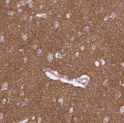 Immunohistochemistry-Paraffin: FRMPD1 Antibody [NBP1-91912]