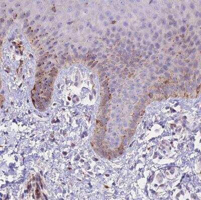 Immunohistochemistry-Paraffin: FRMPD1 Antibody [NBP1-91912]