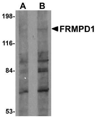 Western Blot: FRMPD1 AntibodyBSA Free [NBP1-77082]