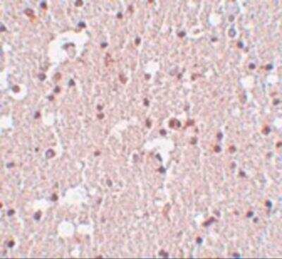 Immunohistochemistry: FRMPD3 Antibody - BSA Free [NBP2-81718]