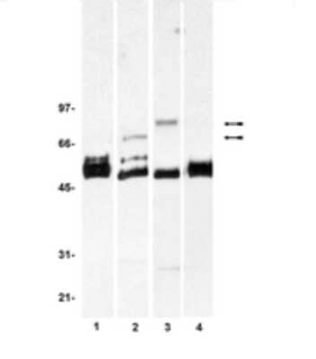 Western Blot: FRS2 Antibody (T5) [NBP2-29886]