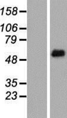 Western Blot: FRS2 Overexpression Lysate [NBP2-09242]