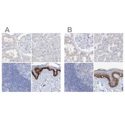 Immunohistochemistry-Paraffin: FRS3 Antibody [NBP1-83420]