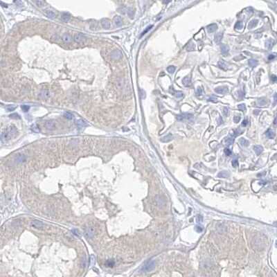 Immunohistochemistry-Paraffin: FRS3 Antibody [NBP1-83420]