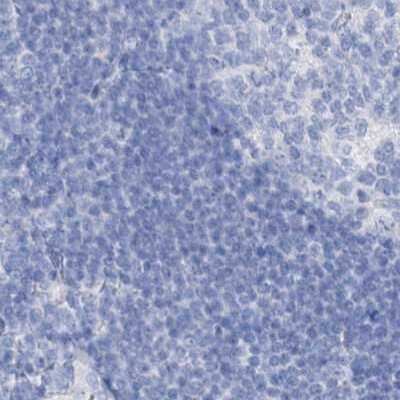 Immunohistochemistry-Paraffin: FRS3 Antibody [NBP1-83420]