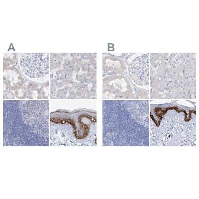 Immunohistochemistry-Paraffin: FRS3 Antibody [NBP1-83421]