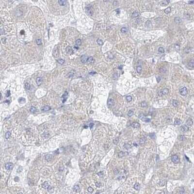 Immunohistochemistry-Paraffin: FRS3 Antibody [NBP1-83421]