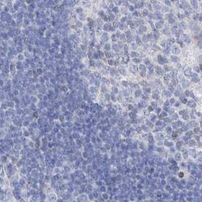 Immunohistochemistry-Paraffin: FRS3 Antibody [NBP1-83421]