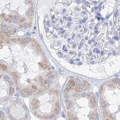 Immunohistochemistry-Paraffin: FRS3 Antibody [NBP1-83421]