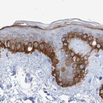 Immunohistochemistry-Paraffin: FRS3 Antibody [NBP1-83421]