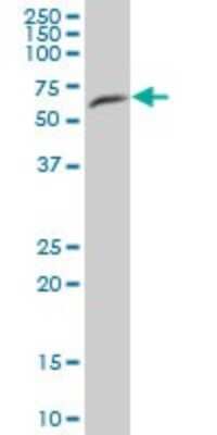 Western Blot: FRS3 Antibody [H00010817-B01P]