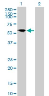Western Blot: FRS3 Antibody [H00010817-B01P]