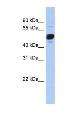 Western Blot: FRS3 Antibody [NBP1-52962]