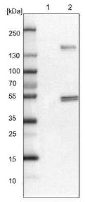 Western Blot: FRS3 Antibody [NBP1-83420]